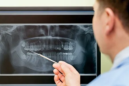 person looking at a xray