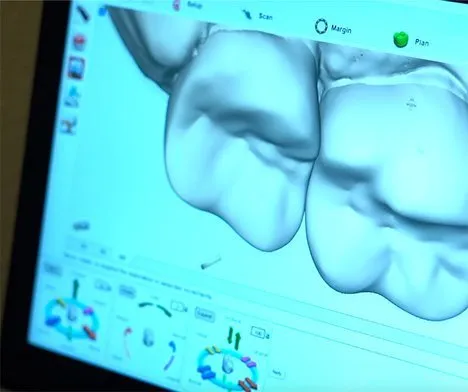 computer screen showing cad cam image