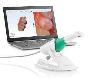 equipment for digital impressions